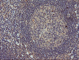 MAP2K3 / MEK3 / MKK3 Antibody - IHC of paraffin-embedded Human tonsil using anti-MAP2K3 mouse monoclonal antibody.