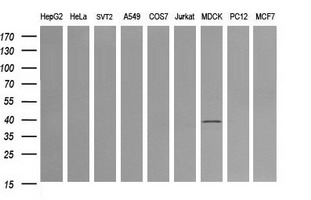 MAP2K3 / MEK3 / MKK3 Antibody - Western blot of extracts (35 ug) from 9 different cell lines by using anti-MAP2K3 monoclonal antibody (HepG2: human; HeLa: human; SVT2: mouse; A549: human; COS7: monkey; Jurkat: human; MDCK: canine; PC12: rat; MCF7: human).
