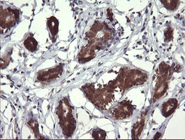 MAP2K3 / MEK3 / MKK3 Antibody - IHC of paraffin-embedded Human breast tissue using anti-MAP2K3 mouse monoclonal antibody.