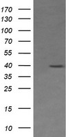 MAP2K3 / MEK3 / MKK3 Antibody - HEK293T cells were transfected with the pCMV6-ENTRY control (Left lane) or pCMV6-ENTRY MAP2K3 (Right lane) cDNA for 48 hrs and lysed. Equivalent amounts of cell lysates (5 ug per lane) were separated by SDS-PAGE and immunoblotted with anti-MAP2K3.