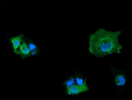 MAP2K3 / MEK3 / MKK3 Antibody - Anti-MAP2K3 mouse monoclonal antibody immunofluorescent staining of COS7 cells transiently transfected by pCMV6-ENTRY MAP2K3.