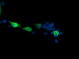 MAP2K3 / MEK3 / MKK3 Antibody - Anti-MAP2K3 mouse monoclonal antibody immunofluorescent staining of COS7 cells transiently transfected by pCMV6-ENTRY MAP2K3.