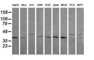 MAP2K3 / MEK3 / MKK3 Antibody - Western blot of extracts (35 ug) from 9 different cell lines by using g anti-MAP2K3 monoclonal antibody (HepG2: human; HeLa: human; SVT2: mouse; A549: human; COS7: monkey; Jurkat: human; MDCK: canine; PC12: rat; MCF7: human).