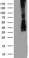 MAP2K3 / MEK3 / MKK3 Antibody - HEK293T cells were transfected with the pCMV6-ENTRY control (Left lane) or pCMV6-ENTRY MAP2K3 (Right lane) cDNA for 48 hrs and lysed. Equivalent amounts of cell lysates (5 ug per lane) were separated by SDS-PAGE and immunoblotted with anti-MAP2K3.