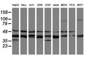 MAP2K3 / MEK3 / MKK3 Antibody - Western blot of extracts (35ug) from 9 different cell lines by using anti-MAP2K3 monoclonal antibody (HepG2: human; HeLa: human; SVT2: mouse; A549: human; COS7: monkey; Jurkat: human; MDCK: canine; PC12: rat; MCF7: human).