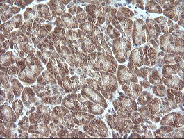 MAP2K3 / MEK3 / MKK3 Antibody - IHC of paraffin-embedded Human pancreas tissue using anti-MAP2K3 mouse monoclonal antibody. (Heat-induced epitope retrieval by 10mM citric buffer, pH6.0, 120°C for 3min).
