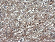 MAP2K3 / MEK3 / MKK3 Antibody - IHC of paraffin-embedded Human liver tissue using anti-MAP2K3 mouse monoclonal antibody.