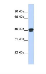 MAP2K3 / MEK3 / MKK3 Antibody - Transfected 293T cell lysate. Antibody concentration: 1.0 ug/ml. Gel concentration: 12%.  This image was taken for the unconjugated form of this product. Other forms have not been tested.