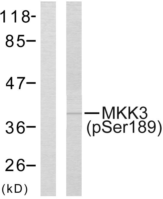 MAP2K3 / MEK3 / MKK3 Antibody - Western blot analysis of lysates from MDA-MB-435 cells, using MKK3 (Phospho-Ser189) Antibody. The lane on the left is blocked with the phospho peptide.