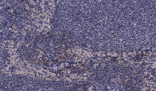 MAP2K3 / MEK3 / MKK3 Antibody - 1:100 staining human lymph node tissue by IHC-P. The tissue was formaldehyde fixed and a heat mediated antigen retrieval step in citrate buffer was performed. The tissue was then blocked and incubated with the antibody for 1.5 hours at 22°C. An HRP conjugated goat anti-rabbit antibody was used as the secondary.