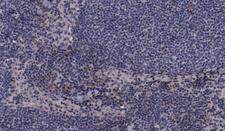 MAP2K3 / MEK3 / MKK3 Antibody - 1:100 staining human lymph node tissue by IHC-P. The tissue was formaldehyde fixed and a heat mediated antigen retrieval step in citrate buffer was performed. The tissue was then blocked and incubated with the antibody for 1.5 hours at 22°C. An HRP conjugated goat anti-rabbit antibody was used as the secondary.