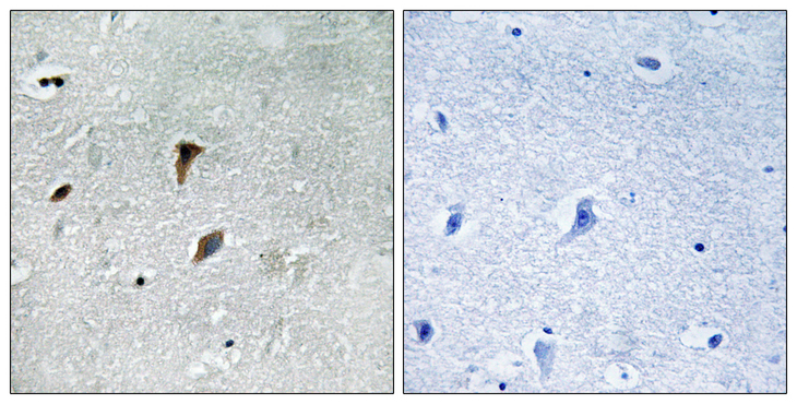 MAP2K3 / MEK3 / MKK3 Antibody - Immunohistochemistry analysis of paraffin-embedded human brain, using MAP2K3 (Phospho-Thr222) Antibody. The picture on the right is blocked with the phospho peptide.