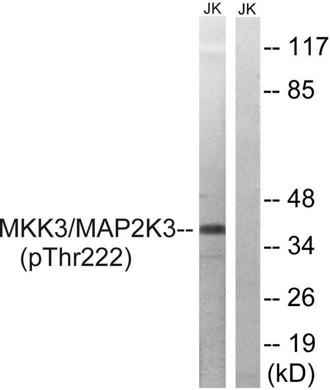 MAP2K3 / MEK3 / MKK3 Antibody - Western blot analysis of lysates from Jurkat cells treated with serum 20% 15', using MAP2K3 (Phospho-Thr222) Antibody. The lane on the right is blocked with the phospho peptide.