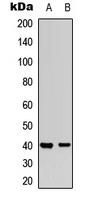 MAP2K3 / MEK3 / MKK3 Antibody - Western blot analysis of MKK3 (pT222) expression in HeLa (A); Jurkat (B) whole cell lysates.