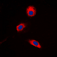 MAP2K3 / MEK3 / MKK3 Antibody - Immunofluorescent analysis of MKK3 (pT222) staining in HeLa cells. Formalin-fixed cells were permeabilized with 0.1% Triton X-100 in TBS for 5-10 minutes and blocked with 3% BSA-PBS for 30 minutes at room temperature. Cells were probed with the primary antibody in 3% BSA-PBS and incubated overnight at 4 deg C in a humidified chamber. Cells were washed with PBST and incubated with a DyLight 594-conjugated secondary antibody (red) in PBS at room temperature in the dark. DAPI was used to stain the cell nuclei (blue).