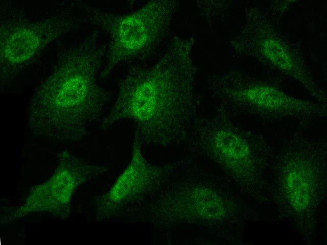 MAP2K3 / MEK3 / MKK3 Antibody - Immunofluorescence staining of MAP2K3 in HeLa cells. Cells were fixed with 4% PFA, permeabilzed with 0.3% Triton X-100 in PBS, blocked with 10% serum, and incubated with rabbit anti-Human MAP2K3 polyclonal antibody (dilution ratio 1:1000) at 4°C overnight. Then cells were stained with the Alexa Fluor 488-conjugated Goat Anti-rabbit IgG secondary antibody (green). Positive staining was localized to cytoplasm and nucleus.