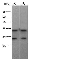MAP2K3 / MEK3 / MKK3 Antibody - Anti-MAP2K3 rabbit polyclonal antibody at 1:500 dilution. Lane A: Jurkat Whole Cell Lysate. Lane B: HeLa Whole Cell Lysate. Lysates/proteins at 30 ug per lane. Secondary: Goat Anti-Rabbit IgG (H+L)/HRP at 1/10000 dilution. Developed using the ECL technique. Performed under reducing conditions. Predicted band size: 39 kDa. Observed band size: 39 kDa.