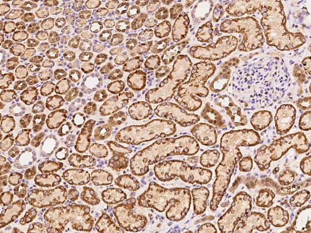 MAP2K3 / MEK3 / MKK3 Antibody - Immunochemical staining MAP2K3 in human kidney with rabbit polyclonal antibody at 1:1000 dilution, formalin-fixed paraffin embedded sections.