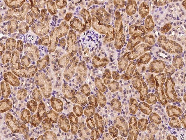 MAP2K3 / MEK3 / MKK3 Antibody - Immunochemical staining MAP2K3 in mouse kidney with rabbit polyclonal antibody at 1:1000 dilution, formalin-fixed paraffin embedded sections.