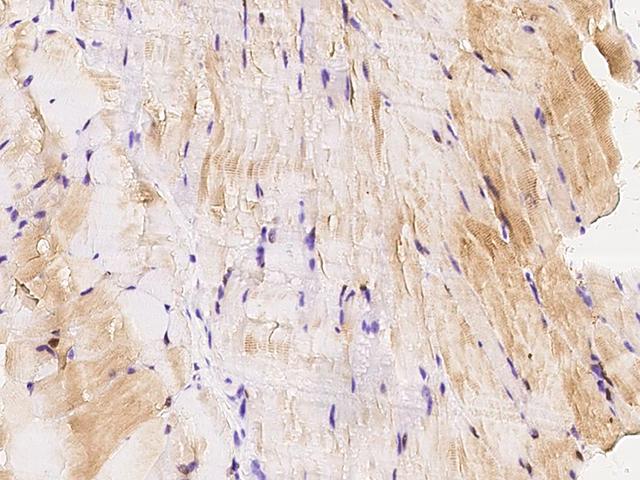 MAP2K3 / MEK3 / MKK3 Antibody - Immunochemical staining MAP2K3 in mouse skeletal muscle with rabbit polyclonal antibody at 1:1000 dilution, formalin-fixed paraffin embedded sections.