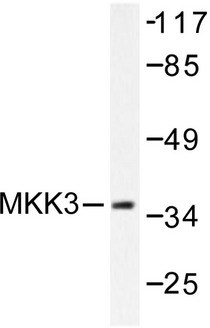 MAP2K3 / MEK3 / MKK3 Antibody - Western blot of MKK3 (S183) pAb in extracts from MDA-MB-435 cells.