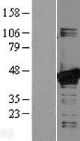 MAP2K3 / MEK3 / MKK3 Protein - Western validation with an anti-DDK antibody * L: Control HEK293 lysate R: Over-expression lysate