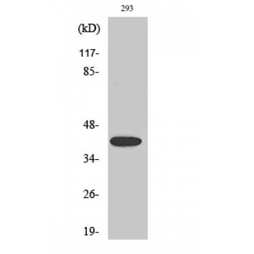 MAP2K4 / MKK4 Antibody - Western blot of Phospho-MEK-4 (S80) antibody