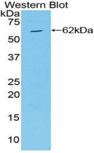 MAP2K4 / MKK4 Antibody - Western blot of recombinant MAP2K4 / MKK4.  This image was taken for the unconjugated form of this product. Other forms have not been tested.
