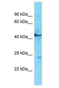 MAP2K4 / MKK4 Antibody - MAP2K4 / MKK4 antibody Western Blot of COLO205. Antibody dilution: 3 ug/ml.  This image was taken for the unconjugated form of this product. Other forms have not been tested.