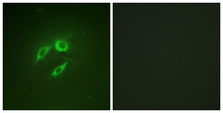 MAP2K4 / MKK4 Antibody - Immunofluorescence analysis of A549 cells, using SEK1/MKK4/JNKK1 Antibody. The picture on the right is blocked with the synthesized peptide.
