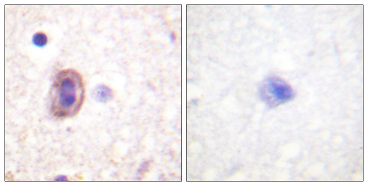 MAP2K4 / MKK4 Antibody - Immunohistochemistry analysis of paraffin-embedded human brain tissue, using SEK1/MKK4/JNKK1 Antibody. The picture on the right is blocked with the synthesized peptide.