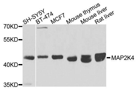 MAP2K4 / MKK4 Antibody - Western blot analysis of extracts of various cells.
