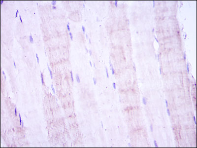 MAP2K4 / MKK4 Antibody - IHC of paraffin-embedded muscle tissues using MAP2K4 mouse monoclonal antibody with DAB staining.