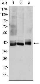 MAP2K4 / MKK4 Antibody - SEK1 Antibody in Western Blot (WB)