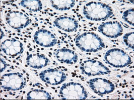 MAP2K4 / MKK4 Antibody - IHC of paraffin-embedded colon tissue using anti-MAP2K4 mouse monoclonal antibody. (Dilution 1:50).