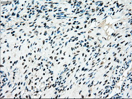 MAP2K4 / MKK4 Antibody - IHC of paraffin-embedded Ovary tissue using anti-MAP2K4 mouse monoclonal antibody. (Dilution 1:50).