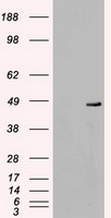 MAP2K4 / MKK4 Antibody - HEK293T cells were transfected with the pCMV6-ENTRY control (Left lane) or pCMV6-ENTRY MAP2K4 (Right lane) cDNA for 48 hrs and lysed. Equivalent amounts of cell lysates (5 ug per lane) were separated by SDS-PAGE and immunoblotted with anti-MAP2K4.