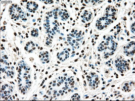 MAP2K4 / MKK4 Antibody - IHC of paraffin-embedded breast tissue using anti-MAP2K4 mouse monoclonal antibody. (Dilution 1:50).