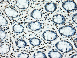 MAP2K4 / MKK4 Antibody - IHC of paraffin-embedded colon tissue using anti-MAP2K4 mouse monoclonal antibody. (Dilution 1:50).