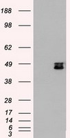 MAP2K4 / MKK4 Antibody - HEK293T cells were transfected with the pCMV6-ENTRY control (Left lane) or pCMV6-ENTRY MAP2K4 (Right lane) cDNA for 48 hrs and lysed. Equivalent amounts of cell lysates (5 ug per lane) were separated by SDS-PAGE and immunoblotted with anti-MAP2K4.