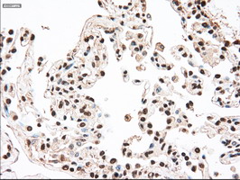 MAP2K4 / MKK4 Antibody - IHC of paraffin-embedded lung tissue using anti-MAP2K4 mouse monoclonal antibody. (Dilution 1:50).