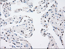 MAP2K4 / MKK4 Antibody - Immunohistochemical staining of paraffin-embedded lung tissue using anti-MAP2K4 mouse monoclonal antibody. (Dilution 1:50).