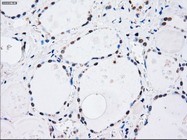 MAP2K4 / MKK4 Antibody - Immunohistochemical staining of paraffin-embedded thyroid tissue using anti-MAP2K4 mouse monoclonal antibody. (Dilution 1:50).