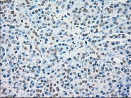 MAP2K4 / MKK4 Antibody - Immunohistochemical staining of paraffin-embedded pancreas tissue using anti-MAP2K4 mouse monoclonal antibody. (Dilution 1:50).
