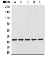 MAP2K4 / MKK4 Antibody - Western blot analysis of MKK4 expression in HeLa (A); HepG2 (B); K562 (C); A431 (D); L929 (E) whole cell lysates.