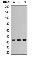 MAP2K4 / MKK4 Antibody - Western blot analysis of MKK4 expression in HepG2 (A); K562 (B); HeLa (C) whole cell lysates.