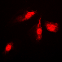 MAP2K4 / MKK4 Antibody - Immunofluorescent analysis of MKK4 staining in HeLa cells. Formalin-fixed cells were permeabilized with 0.1% Triton X-100 in TBS for 5-10 minutes and blocked with 3% BSA-PBS for 30 minutes at room temperature. Cells were probed with the primary antibody in 3% BSA-PBS and incubated overnight at 4 deg C in a humidified chamber. Cells were washed with PBST and incubated with a DyLight 594-conjugated secondary antibody (red) in PBS at room temperature in the dark. DAPI was used to stain the cell nuclei (blue).