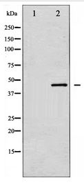 MAP2K4 / MKK4 Antibody - Western blot of SEK1/MKK4 expression in NIH-3T3 whole cell lysates,The lane on the left is treated with the antigen-specific peptide.