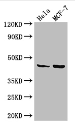 MAP2K4 / MKK4 Antibody - Positive WB detected in:Hela whole cell lysate,MCF-7 whole cell lysate;All lanes: MAP2K4 antibody at 3.25ug/ml;Secondary;Goat polyclonal to rabbit IgG at 1/50000 dilution;Predicted band size: 45,46 kDa;Observed band size: 45 kDa;