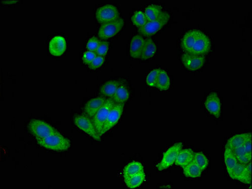 MAP2K4 / MKK4 Antibody - Immunofluorescent analysis of HepG2 cells using MAP2K4 Antibody at a dilution of 1:100 and Alexa Fluor 488-congugated AffiniPure Goat Anti-Rabbit IgG(H+L)
